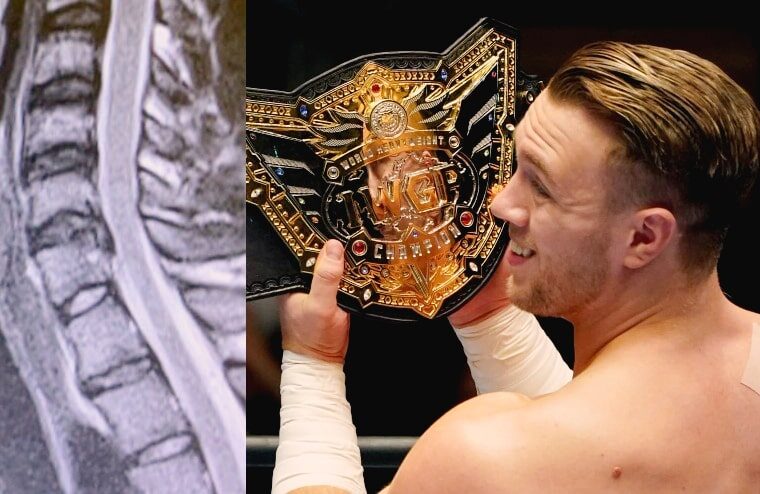 Will Ospreay Shares X-Ray Showing Neck Injury