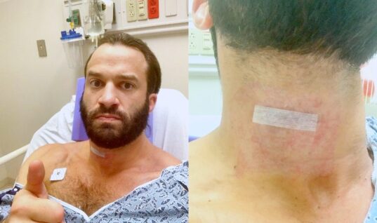 AEW’s Trent Beretta Recovering From Serious Surgery