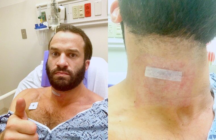 AEW’s Trent Beretta Recovering From Serious Surgery