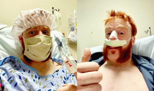 Sheamus Recovering From Second Nose Surgery