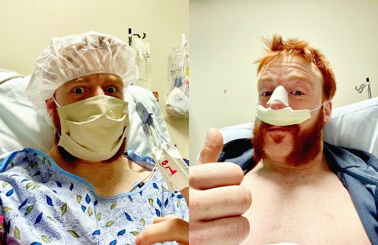 Sheamus Recovering From Second Nose Surgery