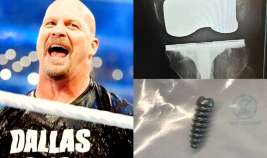 Steve Austin Discloses He Recently Underwent Surgery