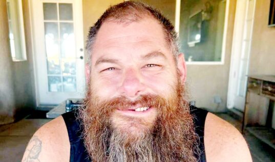 Official Update Shared Regarding Syko Stu’s Health