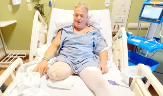 Buff Bagwell Shows Off His New Prosthetic Leg