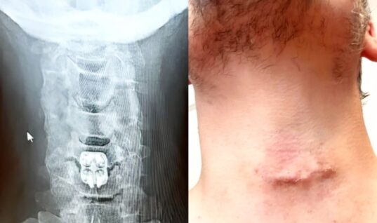 AEW Original Reveals He’s Undergone Neck Surgery
