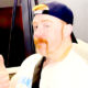 WWE’s Sheamus Undergoes Surgery