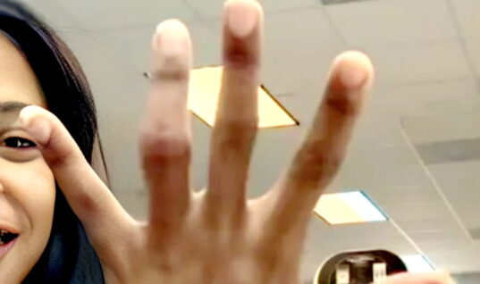 WWE Star Confirms She’s Getting Surgery Nearly One Year After Suffering Injury