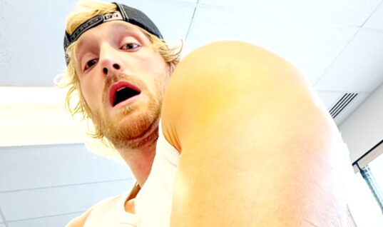 Logan Paul Shows Off Gruesome Tricep Surgery Bruising