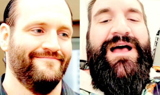 Controversial Wrestler-Turned-YouTuber Streams His Penis Enlargement Surgery
